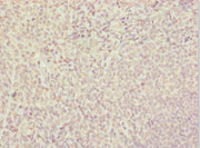 Immunohistochemistry of paraffin-embedded human tonsil tissue using CSB-PA022957ESR2HU at dilution of 1:100