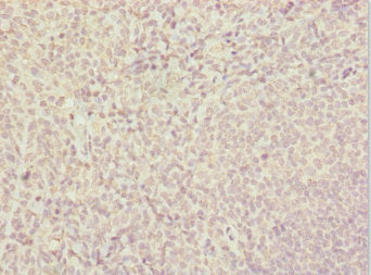 Immunohistochemistry of paraffin-embedded human tonsil tissue using CSB-PA022957ESR2HU at dilution of 1:100