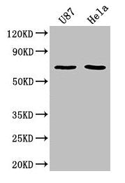 Western Blot Positive WB detected in: U87 whole cell lysate, Hela whole cell lysate All lanes: SUSD5 antibody at 1:2000 Secondary Goat polyclonal to rabbit IgG at 1/50000 dilution Predicted band size: 69 kDa Observed band size: 69 kDa