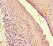 Immunohistochemistry of paraffin-embedded human tonsil tissue using CSB-PA022972LA01HU at dilution of 1:100