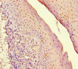 Immunohistochemistry of paraffin-embedded human tonsil tissue using CSB-PA022972LA01HU at dilution of 1:100