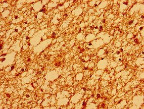 Immunohistochemistry of paraffin-embedded human brain tissue using CSB-PA022978LA01HU at dilution of 1:100