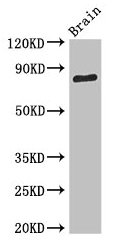 Western Blot Positive WB detected in: Mouse brain tissue All lanes: SV2B antibody at 3.4µg/ml Secondary Goat polyclonal to rabbit IgG at 1/50000 dilution Predicted band size: 78, 61 kDa Observed band size: 78 kDa