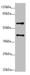 Western blot All lanes: SYCE1 antibody at 3.38ug/ml + Mouse liver tissue Secondary Goat polyclonal to rabbit IgG at 1/10000 dilution Predicted band size: 40, 33, 22 kDa Observed band size: 40, 58 kDa