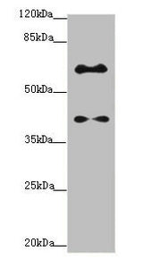Western blot All lanes: SYCE1 antibody at 1.14ug/ml + Mouse liver tissue Secondary Goat polyclonal to rabbit IgG at 1/10000 dilution Predicted band size: 40, 33, 22 kDa Observed band size: 40, 58 kDa