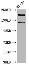 Western Blot Positive WB detected in: HT29 whole cell lysate All lanes: SYNJ1 antibody at 3.7µg/ml Secondary Goat polyclonal to rabbit IgG at 1/50000 dilution Predicted band size: 174, 145, 144, 59 kDa Observed band size: 174 kDa