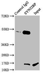 Immunoprecipitating SYNJ2BP in Rat kidney tissue Lane 1: Rabbit control IgG instead of CSB-PA023018LA01HU in Rat kidney tissue. For western blotting, a HRP-conjugated light chain specific antibody was used as the secondary antibody (1/50000) Lane...