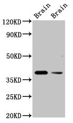 Western Blot Positive WB detected in: Rat brain tissue, Mouse brain tissue All lanes: TAAR5 antibody at 3ug/ml Secondary Goat polyclonal to rabbit IgG at 1/50000 dilution Predicted band size: 39 kDa Observed band size: 39 kDa