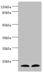 Western blot All lanes: Protachykinin-1 antibody at 6ug/ml Lane 1: Mouse liver tissue Lane 2: 293T whole cell lysate Secondary Goat polyclonal to rabbit IgG at 1/10000 dilution Predicted band size: 16, 14, 12 kDa Observed band size: 16 kDa