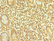 Immunohistochemistry of paraffin-embedded human small intestine tissue using CSB-PA023062ESR2HU at dilution of 1:100