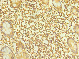 Immunohistochemistry of paraffin-embedded human small intestine tissue using CSB-PA023062ESR2HU at dilution of 1:100