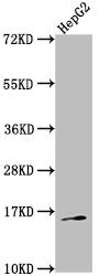Western Blot Positive WB detected in: HepG2 whole cell lysate All lanes: TAC1 antibody at 1:2000 Secondary Goat polyclonal to rabbit IgG at 1/50000 dilution Predicted band size: 16, 14, 12 kDa Observed band size: 16 kDa