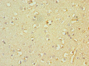 Immunohistochemistry of paraffin-embedded human brain tissue using CSB-PA023070ESR2HU at dilution of 1:100