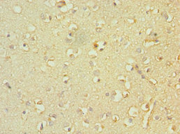 Immunohistochemistry of paraffin-embedded human brain tissue using CSB-PA023070ESR2HU at dilution of 1:100