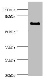 Western blot All lanes: TAF5L antibody at 10ug/ml + Jurkat whole cell lysate Secondary Goat polyclonal to rabbit IgG at 1/10000 dilution Predicted band size: 67, 37 kDa Observed band size: 67 kDa