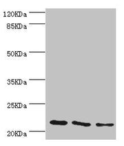 Western blot All lanes: TAGLN2 antibody at 4.04µg/ml Lane 1: 293T whole cell lysate Lane 2: K562 whole cell lysate Lane 3: MCF-7 whole cell lysate Secondary Goat polyclonal to rabbit IgG at 1/10000 dilution Predicted band size: 23, 25 kDa Observed...