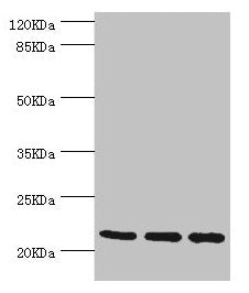 Western blot All lanes: TAGLN2 antibody at 2.64µg/ml Lane 1: 293T whole cell lysate Lane 2: K562 whole cell lysate Lane 3: MCF-7 whole cell lysate Secondary Goat polyclonal to rabbit IgG at 1/10000 dilution Predicted band size: 23, 25 kDa Observed...