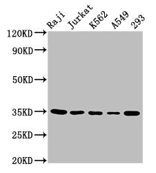 Western Blot Positive WB detected in: Raji whole cell lysate, Jurkat whole cell lysate, K562 whole cell lysate, A549 whole cell lysate, 293 whole cell lysate All lanes: TAL1 antibody at 5.5µg/ml Secondary Goat polyclonal to rabbit IgG at 1/50000 d...