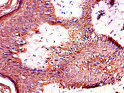 Immunohistochemistry of paraffin-embedded human skin tissue using CSB-PA023116LA01HU at dilution of 1:100