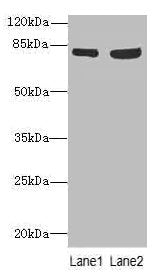 Western blot All lanes: TARS antibody at 4.85µg/ml Lane 1: A549 whole cell lysate Lane 2: Hela whole cell lysate Secondary Goat polyclonal to rabbit IgG at 1/10000 dilution Predicted band size: 84, 87 kDa Observed band size: 84 kDa