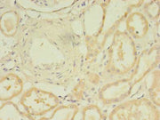 Immunohistochemistry of paraffin-embedded human kidney tissue using CSB-PA023132LA01HU at dilution of 1:100