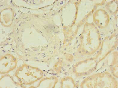 Immunohistochemistry of paraffin-embedded human kidney tissue using CSB-PA023132LA01HU at dilution of 1:100