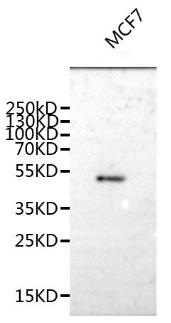 Western Blot Positive WB detected in: MCF-7 whole cell lysate All lanes: SPCS3 antibody at 1:1000 Secondary Goat polyclonal to rabbit IgG at 1/50000 dilution Predicted band size: 51 kDa Observed band size: 51kDa