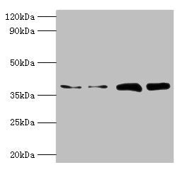 Western blot All lanes: TBCC antibody at 2µg/ml Lane 1: Hela whole cell lysate Lane 2: HepG2 whole cell lysate Lane 3: A549 whole cell lysate Lane 4: MCF-7 whole cell lysate Secondary Goat polyclonal to rabbit IgG at 1/10000 dilution Predicted ban...