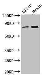 Western Blot Positive WB detected in: Mouse liver tissue, Mouse brain tissue All lanes: TBK1 antibody at 3ug/ml Secondary Goat polyclonal to rabbit IgG at 1/50000 dilution Predicted band size: 84 kDa Observed band size: 84 kDa