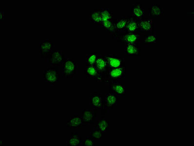 Immunofluorescence staining of Hela cells with CSB-PA023233LA01HU at 1:100, counter-stained with DAPI. The cells were fixed in 4% formaldehyde, permeabilized using 0.2% Triton X-100 and blocked in 10% normal Goat Serum. The cells were then incubat...