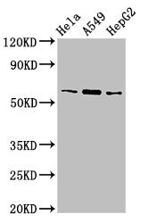 Western Blot Positive WB detected in: Hela whole cell lysate, A549 whole cell lysate, HepG2 whole cell lysate All lanes: TBL1X antibody at 3µg/ml Secondary Goat polyclonal to rabbit IgG at 1/50000 dilution Predicted band size: 63, 58 kDa Observed...