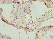 Immunohistochemistry of paraffin-embedded human testis tissue using CSB-PA023240ESR1HU at dilution of 1:100