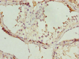 Immunohistochemistry of paraffin-embedded human testis tissue using CSB-PA023240ESR1HU at dilution of 1:100