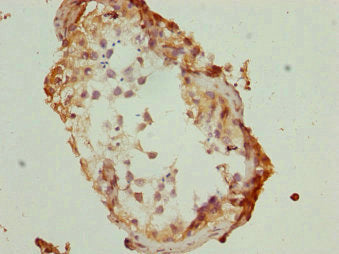 Immunohistochemistry of paraffin-embedded human testis tissue using CSB-PA023240ESR2HU at dilution of 1:100
