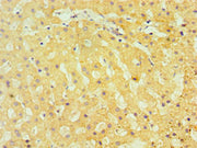 Immunohistochemistry of paraffin-embedded human liver tissue using CSB-PA023243DSR1HU at dilution of 1:100