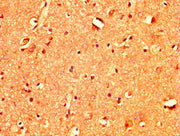 IHC image of CSB-PA023255LA01HU diluted at 1:400 and staining in paraffin-embedded human brain tissue performed on a Leica BondTM system. After dewaxing and hydration, antigen retrieval was mediated by high pressure in a citrate buffer (pH 6.0). S...