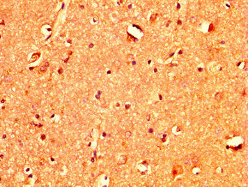 IHC image of CSB-PA023255LA01HU diluted at 1:400 and staining in paraffin-embedded human brain tissue performed on a Leica BondTM system. After dewaxing and hydration, antigen retrieval was mediated by high pressure in a citrate buffer (pH 6.0). S...