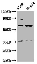Western Blot Positive WB detected in: A549 whole cell lysate, HepG2 whole cell lysate All lanes: TBX4 antibody at 4.3µg/ml Secondary Goat polyclonal to rabbit IgG at 1/50000 dilution Predicted band size: 61 kDa Observed band size: 61 kDa