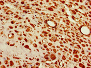 Immunohistochemistry of paraffin-embedded human placenta tissue using CSB-PA023258LA01HU at dilution of 1:100