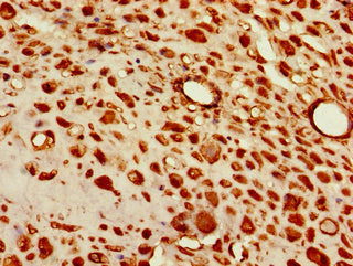 Immunohistochemistry of paraffin-embedded human placenta tissue using CSB-PA023258LA01HU at dilution of 1:100