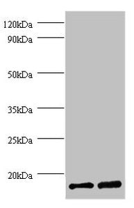 Western blot All lanes: FKBP1A antibody at 2µg/ml Lane 1: EC109 whole cell lysate Lane 2: 293T whole cell lysate Secondary Goat polyclonal to rabbit IgG at 1/15000 dilution Predicted band size: 12 kDa Observed band size: 12 kDa