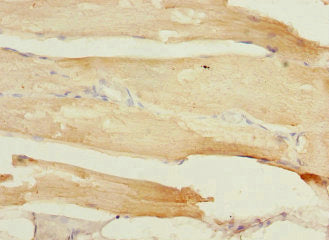 Immunohistochemistry of paraffin-embedded human skeletal muscle tissue using CSB-PA023264ESR1HU at dilution of 1:100