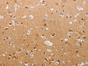 The image on the left is immunohistochemistry of paraffin-embedded Human brain tissue using CSB-PA023267(PFN2 Antibody) at dilution 1/30, on the right is treated with synthetic peptide. (Original magnification: ×200)