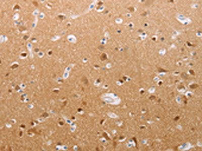 The image on the left is immunohistochemistry of paraffin-embedded Human brain tissue using CSB-PA023267(PFN2 Antibody) at dilution 1/30, on the right is treated with synthetic peptide. (Original magnification: ×200)