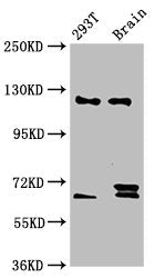 Western Blot Positive WB detected in: 293T whole cell lysate, Rat brain tissue All lanes: TCERG1 antibody at 5.9ug/ml Secondary Goat polyclonal to rabbit IgG at 1/50000 dilution Predicted band size: 124, 122 kDa Observed band size: 124 kDa