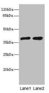 Western blot All lanes: TCF19 antibody at 0.96ug/ml Lane 1: 293T whole cell lysate Lane 2: Rat thymus tissue Secondary Goat polyclonal to rabbit IgG at 1/10000 dilution Predicted band size: 37 kDa Observed band size: 37 kDa