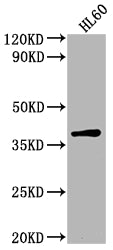 Western Blot Positive WB detected in: HL60 whole cell lysate All lanes: TCF19 antibody at 1:2000 Secondary Goat polyclonal to rabbit IgG at 1/50000 dilution Predicted band size: 38 kDa Observed band size: 38 kDa