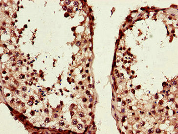 Immunohistochemistry of paraffin-embedded human testis tissue using CSB-PA023301HA01HU at dilution of 1:100