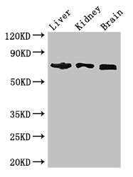 Western Blot Positive WB detected in: Mouse liver tissue, Mouse kidney tissue, Mouse brain tissue All lanes: TCF4 antibody at 2.7ug/ml Secondary Goat polyclonal to rabbit IgG at 1/50000 dilution Predicted band size: 72, 55, 49, 66, 65, 58, 68, 64,...