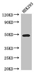 Western Blot Positive WB detected in: HEK293 whole cell lysate All lanes: TCN2 antibody at 3.5µg/ml Secondary Goat polyclonal to rabbit IgG at 1/50000 dilution Predicted band size: 48, 45 kDa Observed band size: 48 kDa